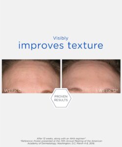 Smooth Surface Glycolic Peel Pads. Före- och efter-bild