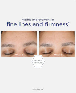 Hyaluronic Luminous Lift. Före och efter-bild
