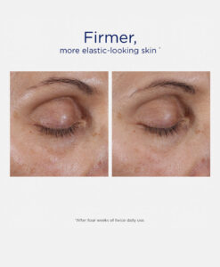 Intensive Eye Therapy. Före- och efter.